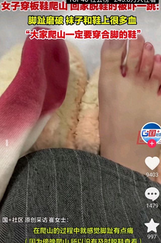 女子穿板鞋爬山回家脫鞋時被嚇一跳