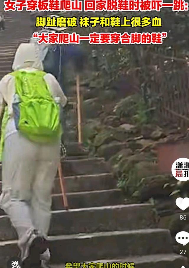 女子穿板鞋爬山回家脫鞋時被嚇一跳